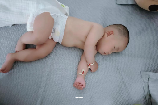 楚雄宝宝褶皱处擦粉还是油